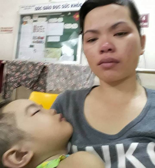 Thương bé gái người Tày vừa bị ung thư máu vừa hoại tử chân - 7 Chị Nông Thị Thảo nghẹn ngào khi kể về nỗi đau đớn của con gái nhỏ
