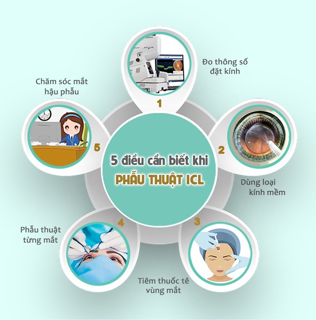 5 điều cần biết về mổ cận thị nặng bằng ICL - 2 5 điều cần biết về mổ cận thị nặng bằng ICL - 2