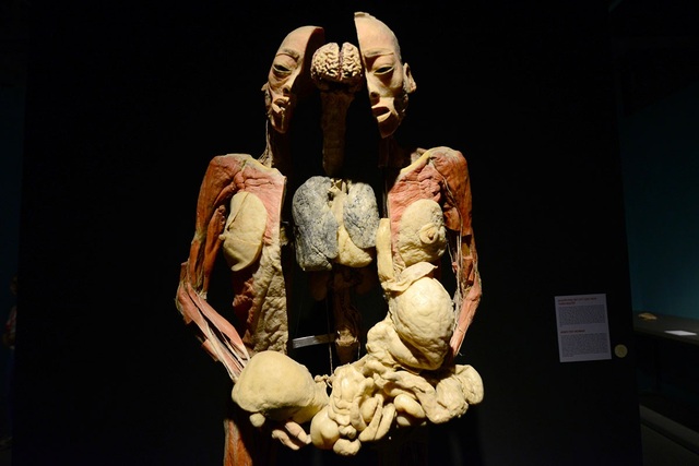 Những hình ảnh ám ảnh trong triển lãm nội tạng, cơ thể người ở ...
