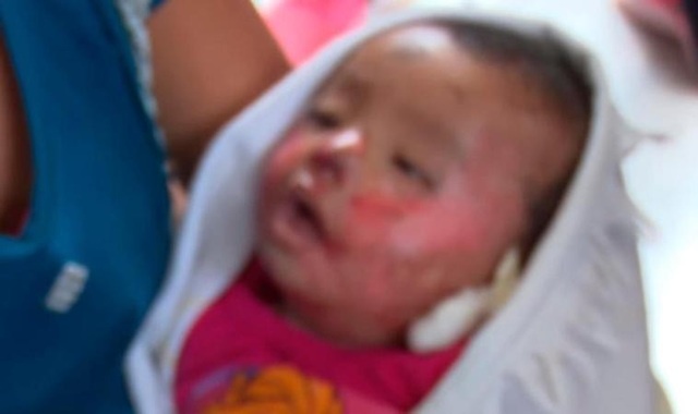 Bé 7 tháng tuổi choàng mở mắt trong vòng tay mẹ vào tang lễ của mình - 3 Cô bé mở mắt trong vòng tay mẹ
