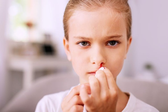 Chảy máu cam – cần chú ý những gì? - 1 Chảy máu cam – cần chú ý những gì? - 1
