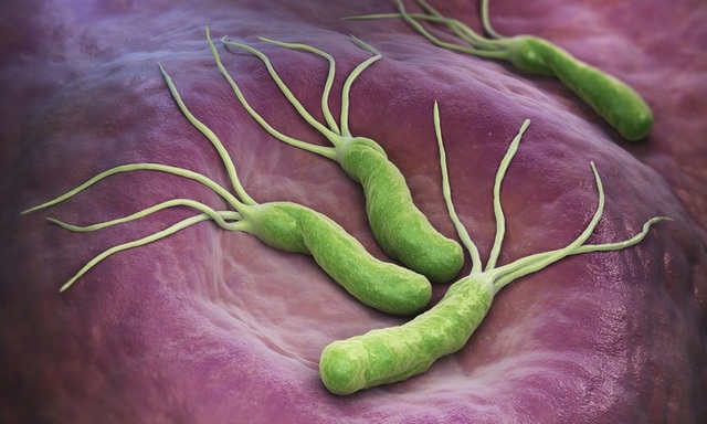 Nguyên nhân tiềm ẩn gây ung thư dạ dày - 2
Nhiễm khuẩn HP (Helicobacter Pylori)