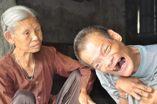 Chan bát cơm đầy nước mắt, mẹ già 85 tuổi nghẹn ngào chăm con trai bị chất độc da cam - 4 36 năm rồi, anh Sáng vẫn như 1 đứa trẻ thơ.