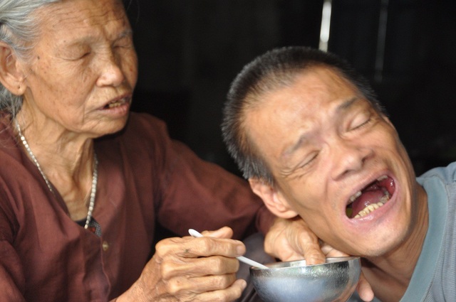 Chan bát cơm đầy nước mắt, mẹ già 85 tuổi nghẹn ngào chăm con trai bị chất độc da cam - 6 Cuộc sống của hai mẹ con với bữa đói, bữa no.