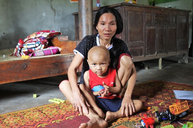 Xót xa cảnh anh trai 22 tuổi bị bại não, em 4 tuổi bị ung thư xương - 1 Sau chuỗi ngày nằm điều trị ở bệnh viện Nhi Trung ương, bé Giáp được về nhà nghỉ ngơi 1 tuần.