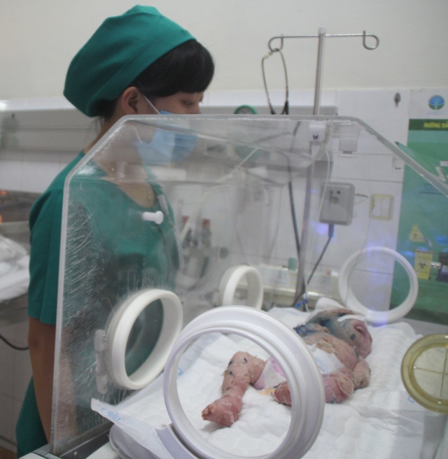 Bé 2 tháng tuổi mắc bệnh hiếm gặp "da vảy cá" - 1 Bé N.H.H. đang được tích cực điều trị tại Bệnh viện Nhi đồng Đồng Nai.