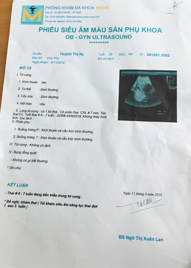 Thai khỏe mạnh, bệnh viện chẩn đoán chết lưu - 2 Trong khi đó các nơi khác tại TP Huế chẩn đoán thai bình thường, đang tiến triển trong tử cung