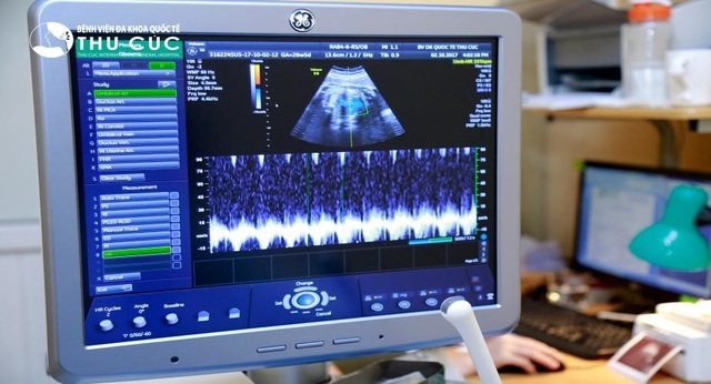 Lần đầu tiên làm mẹ và hội chứng “nghiện” siêu âm - 4 Lạm dụng sóng siêu âm có thể gây dị tật cho thai nhi