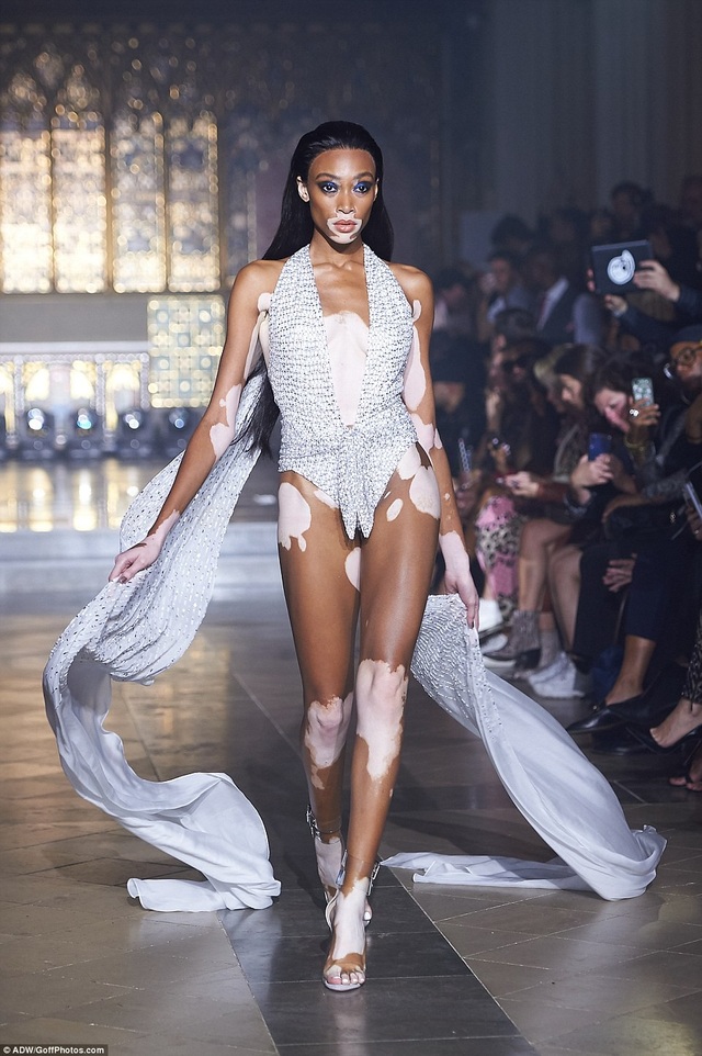 Dàn mẫu bốc lửa trên sàn catwalk - 2
Winnie Harlow là siêu mẫu bị bạch biến