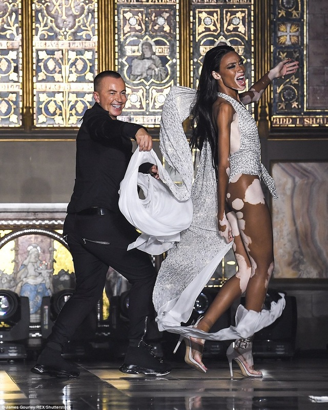 Dàn mẫu bốc lửa trên sàn catwalk - 13
Winnie Harlow sắp xuất hiện trong show diễn của Victorias Secret