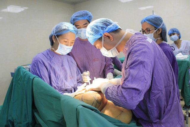 Người phụ nữ khốn khổ vì ngực lệch, một bên to gấp 5 lần bên còn lại - 1 Các bác sĩ đã cắt bỏ đến 2kg khối u làm ngực trái bệnh nhân lớn gấp 4 - 5 lần ngực phải.