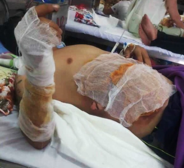 “Cần thủ” bỏng nặng vì câu cá dưới đường điện cao thế - 1
Cần câu chạm vào đường điện cao thế gây phóng điện.