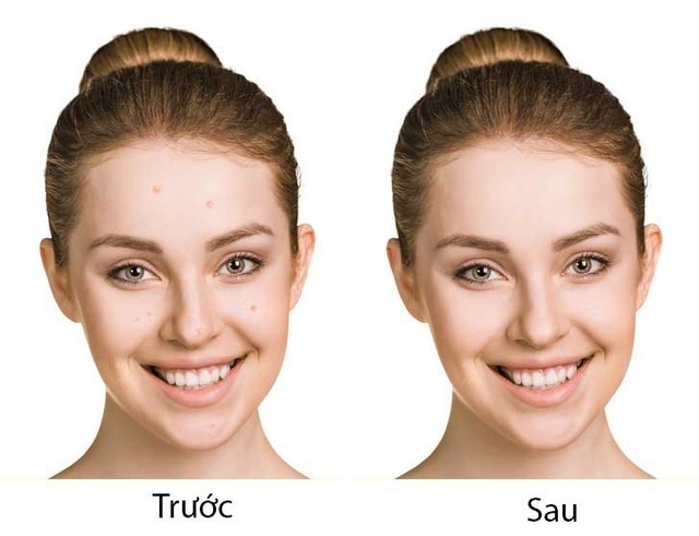 Cơ thể bạn sẽ ra sao khi uống dầu cá hàng ngày? - 10
