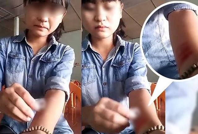 Giới trẻ cắt tay, cạo da: TS Tâm lý Trần Thành Nam nói gì? - 2
Cô gái ở Nghệ An cắt tay ngay sau khi chia tay người yêu.