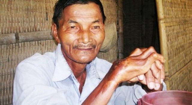 Kỳ thú câu chuyện về những “siêu nhân” có thật trên thế giới - 2 Kỳ thú câu chuyện về những “siêu nhân” có thật trên thế giới - 2
