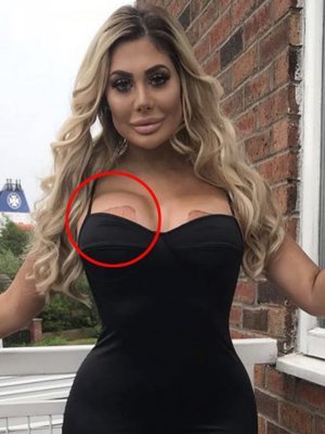 Chloe Ferry lại khoe thân hình dao kéo - 9 Chloe Ferry lại khoe thân hình dao kéo - 9