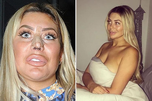 Chloe Ferry lại khoe thân hình dao kéo - 7 Chloe Ferry lại khoe thân hình dao kéo - 7