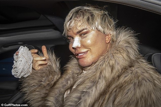 Búp bê Ken Rodrigo Alves lộ mặt sưng phồng sau ca dao kéo - 2 Búp bê Ken Rodrigo Alves lộ mặt sưng phồng sau ca dao kéo - 2