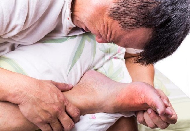 Tại sao bệnh gout thường xảy ra ở các khớp lớn của chân? 
