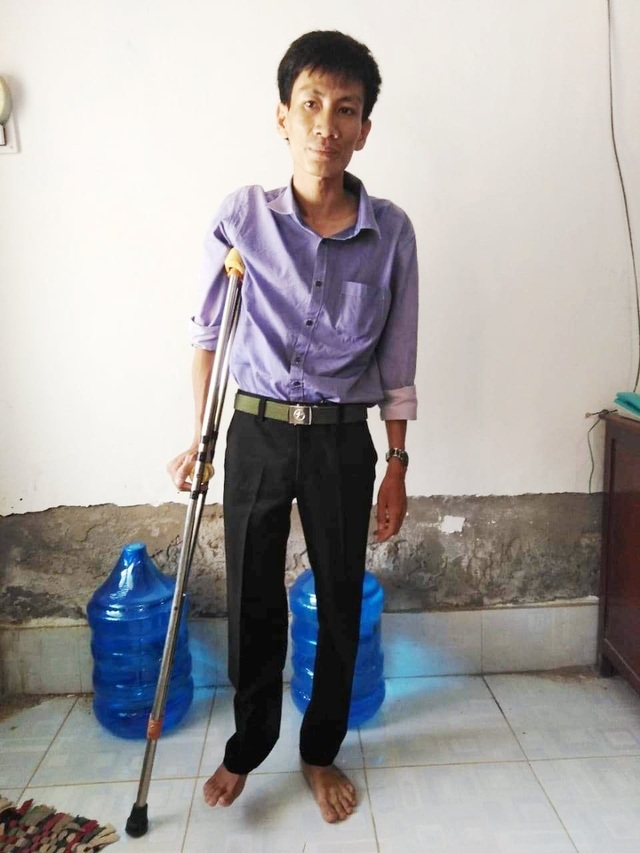 Xương chân phải bị mục chỉ còn mạch máu, nam thanh niên cần phẫu thuật cấp - 1 Xương chân phải bị mục chỉ còn mạch máu, nam thanh niên cần phẫu thuật cấp - 1
