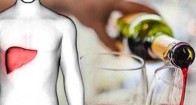 Giáo sư chỉ cách phát hiện bệnh gan sau Tết phòng nguy cơ đột tử - 1 Giáo sư chỉ cách phát hiện bệnh gan sau Tết phòng nguy cơ đột tử - 1