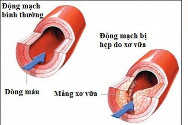 u-tai-1.jpg u-tai-1.jpg