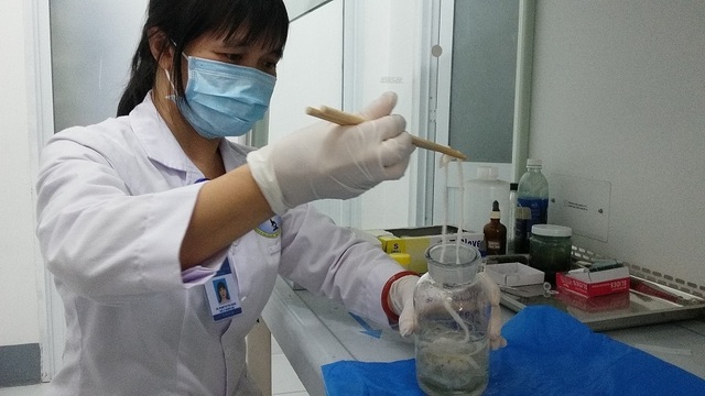 Xét nghiệm dương tính: Chưa thể khẳng định cơ thể có sán! - 4 Xét nghiệm dương tính: Chưa thể khẳng định cơ thể có sán! - 4