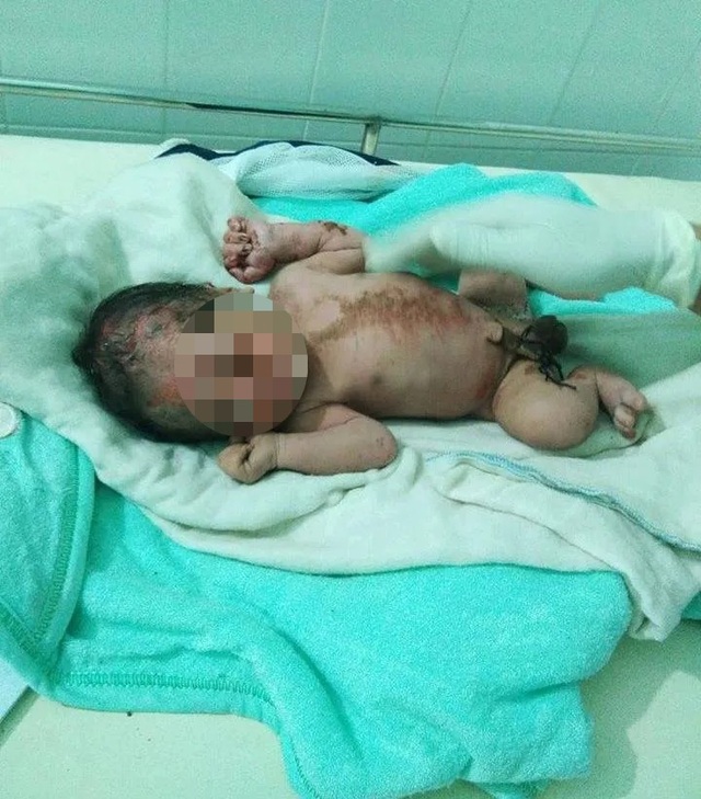 Phát hiện bé trai sơ sinh còn dây rốn bên bờ suối - 1 Phát hiện bé trai sơ sinh còn dây rốn bên bờ suối - 1