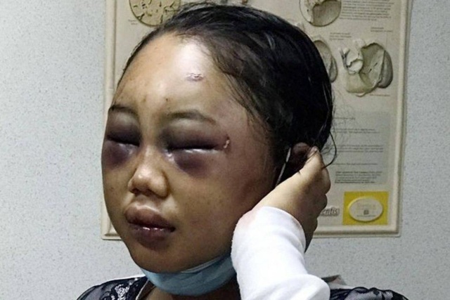 Chấn động những vụ ngược đãi người giúp việc nước ngoài tại châu Á - 1 Chấn động những vụ ngược đãi người giúp việc nước ngoài tại châu Á - 1