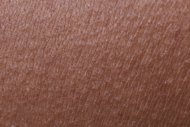 10 biểu hiện “lạ” ở da có thể là báo hiệu một căn bệnh nghiêm trọng - 1
