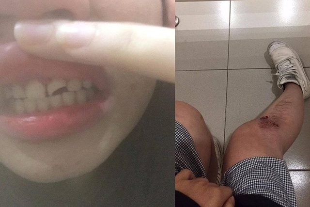 Nghi ngờ đối tượng bệnh hoạn gây tai nạn rồi xâm hại các cô gái trẻ - 1 Nghi ngờ đối tượng bệnh hoạn gây tai nạn rồi xâm hại các cô gái trẻ - 1