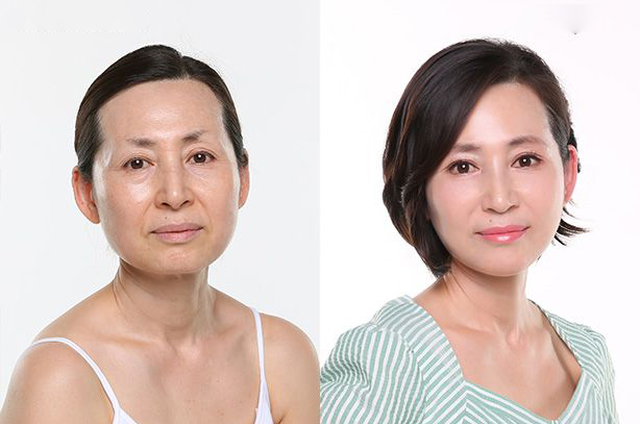 Giải pháp dành cho làn da lão hóa tuổi trung niên - 1