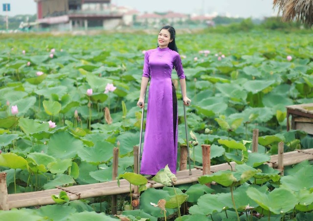 Cô gái không may mất một chân đăng quang Hoa khôi Vầng trăng khuyết - 5