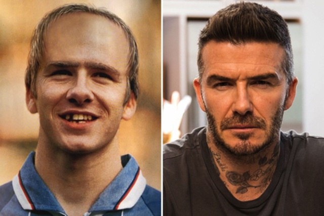 Hài hước với hình ảnh Beckham rụng răng, hói đầu vào năm… 2020