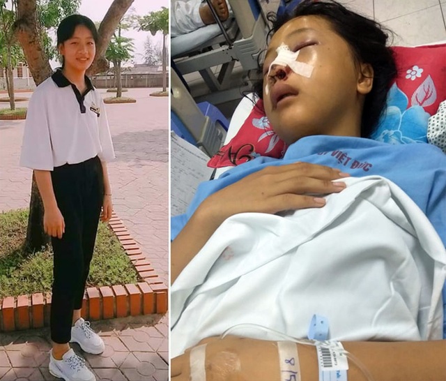 Bị tài xế say xỉn tông trúng, nữ sinh lớp 9 hôn mê suốt nhiều ngày - 1 Bị tài xế say xỉn tông trúng, nữ sinh lớp 9 hôn mê suốt nhiều ngày - 1