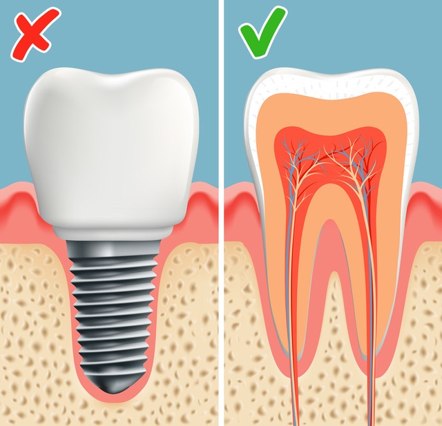 Công nghệ khiến răng tự mọc lại sau khi rụng: Sẽ không còn ai phải trồng răng! - 5 Công nghệ khiến răng tự mọc lại sau khi rụng: Sẽ không còn ai phải trồng răng! - 5