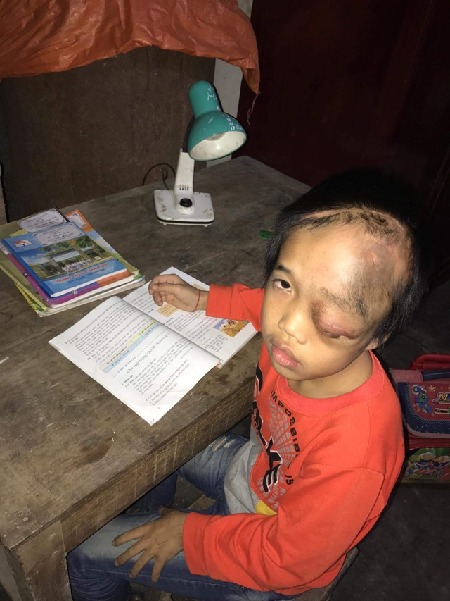 Người cựu binh tuyến lửa không sợ bom đạn hằng đêm nằm ôm con khóc - 4 Người cựu binh tuyến lửa không sợ bom đạn hằng đêm nằm ôm con khóc - 4