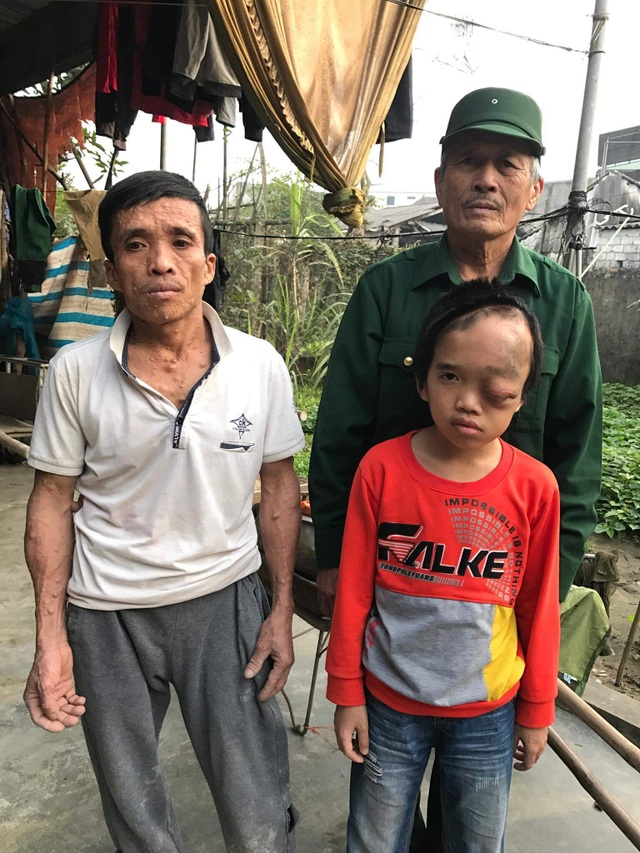 Người cựu binh tuyến lửa không sợ bom đạn hằng đêm nằm ôm con khóc - 1 Người cựu binh tuyến lửa không sợ bom đạn hằng đêm nằm ôm con khóc - 1