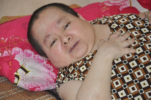 Rớt nước mắt cảnh “người cá” vượt trăm cây số nương nhờ em gái bát cháo qua ngày - 8 Rớt nước mắt cảnh “người cá” vượt trăm cây số nương nhờ em gái bát cháo qua ngày - 8
