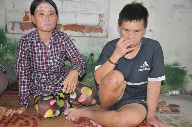 Khuôn mặt lạ của chị Đặm điếc rạng ngời khi được bạn đọc Dân trí quan tâm giúp đỡ hơn 50 triệu đồng - 4 Khuôn mặt lạ của chị Đặm điếc rạng ngời khi được bạn đọc Dân trí quan tâm giúp đỡ hơn 50 triệu đồng - 4