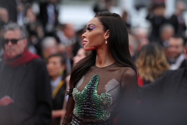 Winnie Harlow sexy với váy xuyên thấu - 9 Winnie Harlow sexy với váy xuyên thấu - 9