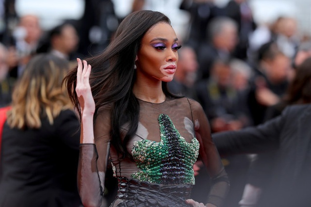 Winnie Harlow sexy với váy xuyên thấu - 3 Winnie Harlow sexy với váy xuyên thấu - 3