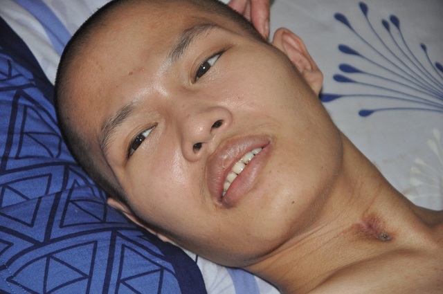 Hạnh phúc vỡ òa của chàng trai trẻ bị viêm não được cứu sống nhờ bạn đọc Dân trí - 3 Hạnh phúc vỡ òa của chàng trai trẻ bị viêm não được cứu sống nhờ bạn đọc Dân trí - 3