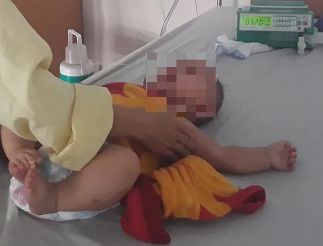 Quảng Bình: Bé gái 6 tháng tuổi phải cắt bỏ buồng trứng vì gia đình không đưa đi viện sớm - 1 Quảng Bình: Bé gái 6 tháng tuổi phải cắt bỏ buồng trứng vì gia đình không đưa đi viện sớm - 1