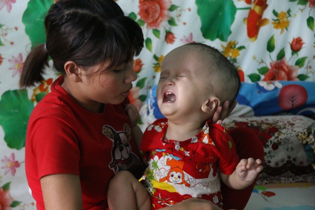 “Trong người chỉ còn vài chục ngàn thì làm sao em đưa con đi mổ được!” - 1 “Trong người chỉ còn vài chục ngàn thì làm sao em đưa con đi mổ được!” - 1