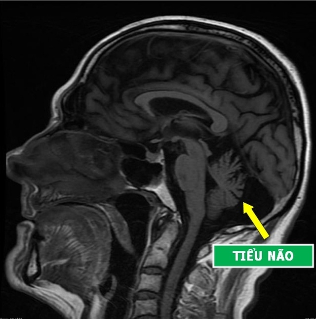 Những hình chụp X-quang giúp chúng ta hiểu hơn về cơ thể mình - 4 Những hình chụp X-quang giúp chúng ta hiểu hơn về cơ thể mình - 4