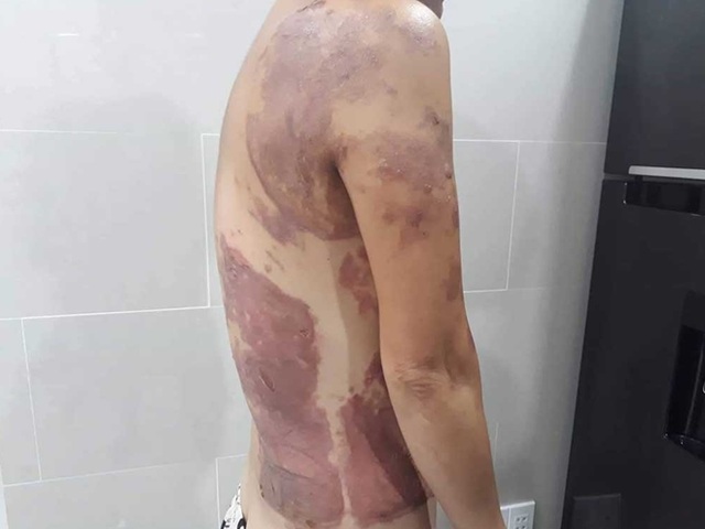 Nhắc nhở đậu xe bị hắt nguyên chảo dầu ăn vào người - 1 Nhắc nhở đậu xe bị hắt nguyên chảo dầu ăn vào người - 1