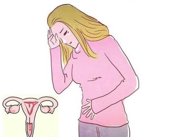 Biến chứng của u xơ tử cung nguy hiểm như thế nào? - 1 Biến chứng của u xơ tử cung nguy hiểm như thế nào? - 1
