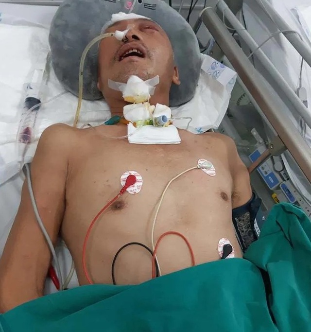 Nỗi đau cùng cực của người đàn bà ung thư bất lực nhìn chồng chấn thương sọ não - 1 Nỗi đau cùng cực của người đàn bà ung thư bất lực nhìn chồng chấn thương sọ não - 1