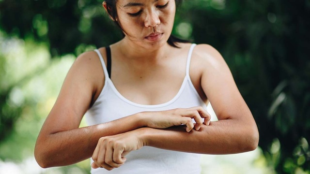 Tại sao muỗi đốt lại ngứa? | Báo Dân trí